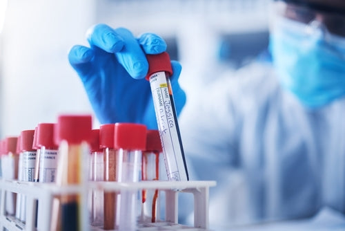 Blood tests