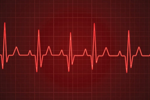 Electrocardiogram (ECG)