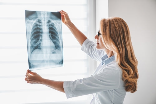 Chest X-ray